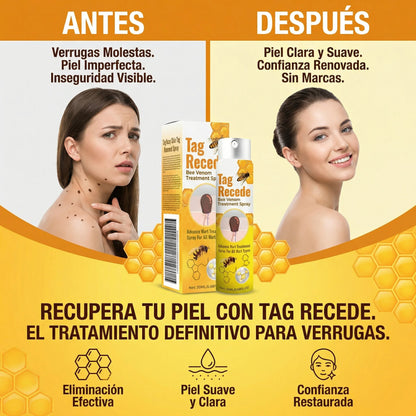 Tratamiento natural elimina verrugas 2x1
